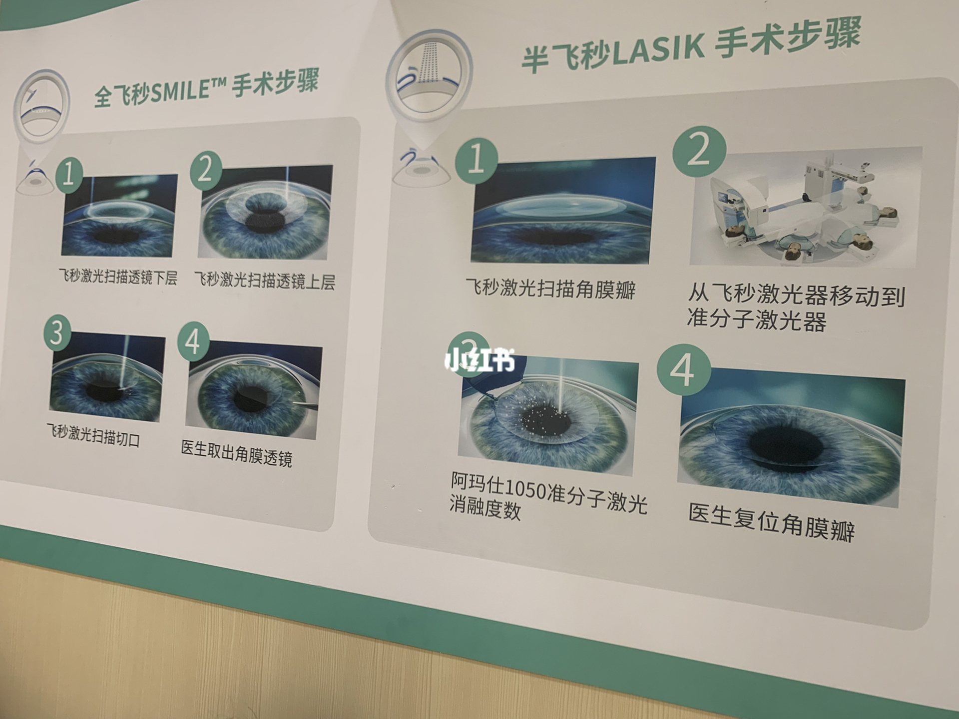 最新近视手术，科技重塑视界新篇章
